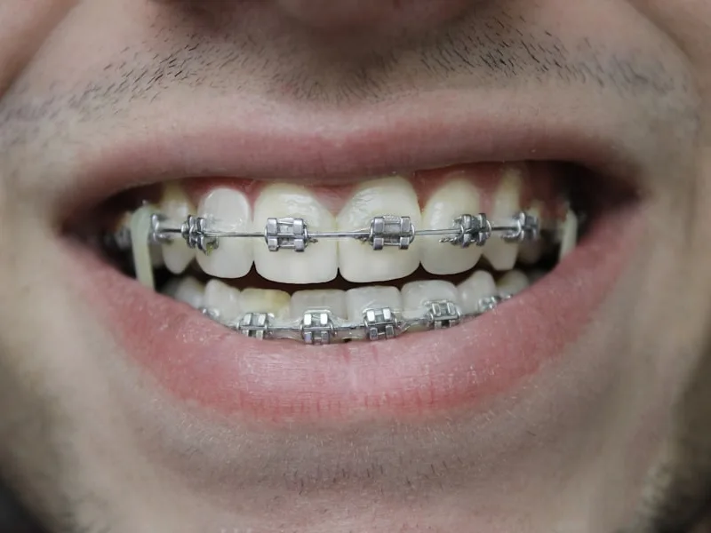 Orthodontics