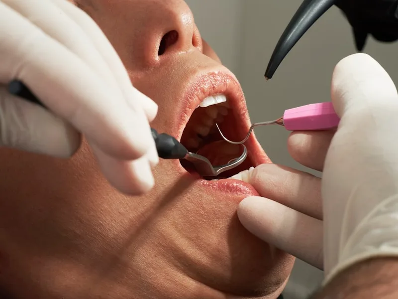 Root Canal Treatment